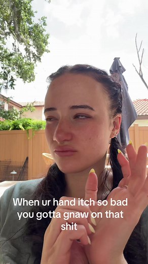 Dealing with an Unbearable Hand Itch
