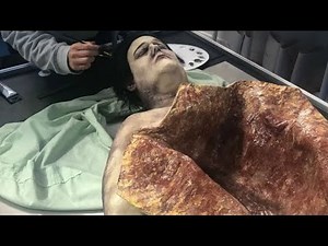 Dissection of human body (abdominal part) | Human Anatomy Dissection ‪@DrTasnimJara‬