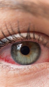 Does hypoallergenic adhesive work for sensitive eyes? Watch to find out! ✨ Visit carolinaeyecandy.com for more! | Carolina Eye Candy Beauty & Relaxation Lounge