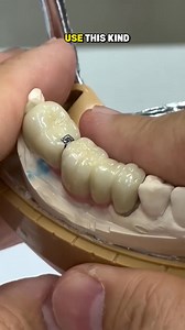 274K views · 1.3K reactions | What if the teeth have no common path...