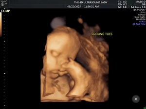 15K views · 794 reactions | Yep, babies can gnaw on their toes, even in the womb! #30weeks | The 4D Ultrasound Lady | Facebook