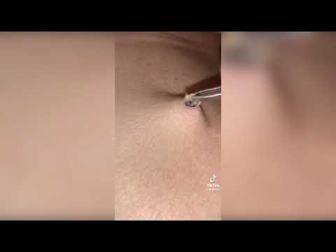 Pore of winer extraction