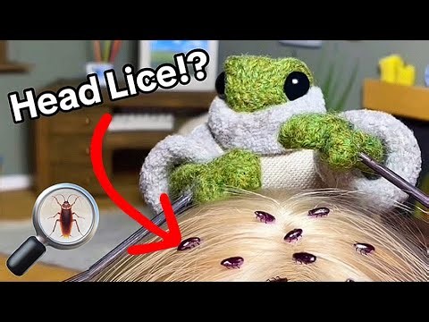 ASMR Froggie Friend Gives You a Lice Check!🪳| Tingly Relaxing Sounds for Your Scalp