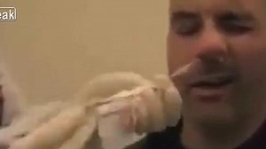 Disgusting clip shows 5-FOOT long tapeworm extracted from man's nose