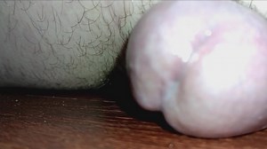 Chernobyl Disaster Left One Survivor With A Huge Mutated Dick