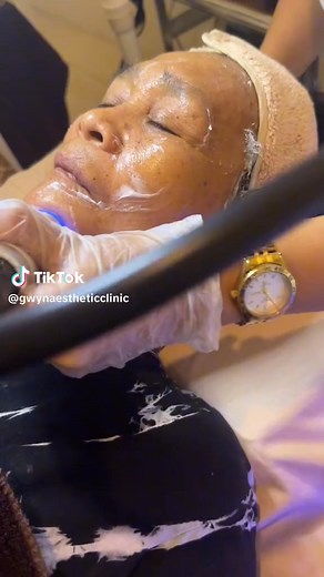 BENEFITS OF LIPO CAVITATION👉Fat dissolution, cellulite reduction and body contouring👉Wrinkles removal, skin tightening and enhance the skin elasticity👉Skin rejuvenation👉Improving enlarged pore and tender white skin👉Skin metabolism improvementRF Face and BodyBENEFITS OF RF (Radio Frequency) 👉Face and Neck Lifting & Remodelling👉Tightening and lifting flaccid areas of the face👉Reduces wrinkles / lift sagging skin👉Enhances luminosity of the skin👉Fat Reduction👉Body Remodelling 👉Cellulite