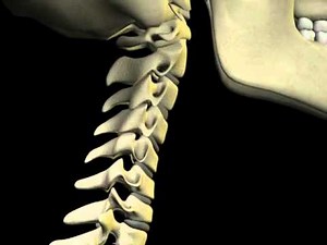 Cervical Degeneration Animation by 3D Practice