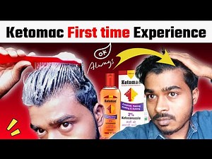 Ketomac 2% First time use Experience || Dandruff Shampoo || Control Flaking Scaling & itching...