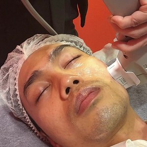 HIFU Treatment Benefits: ✅ Skin lifting and tightening ✅ Pores reduction ✅ Wrinkle reduction ✅ Eyebrow lifting  Tightening sagging skin on face and neck  Enhance jawline definition  Reduce wrinkles  The result is immediate and long-lasting  non-invasive does not have any downtime #HIFU #HIFUFacial #hifutreatment #fyppage #DrNano #drnanolabcel #fypviralシ | Drnanolabcel | Facebook