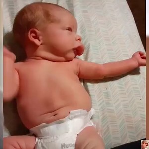 31K views · 1.3K reactions | Strong Baby With Hemangioma | Newborn Babies | Facebook