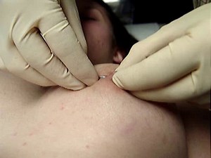 Piercing a nipple.