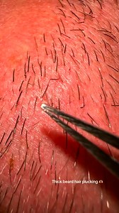 Satify✌️✨Beard pili multigemini hair #reels #asmr #husband #contentmonetization #plucking #multigemini #beard | Lucia Martini