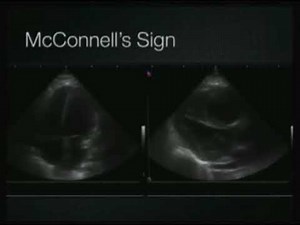 Cardiac ultrasound Cases