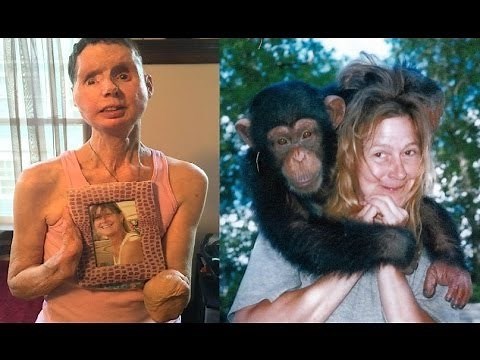 8 Unerwartete Tierangriffe auf Menschen