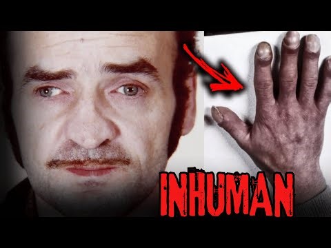 The American VETERAN Women Serial Killer - A case of Fritz Honka