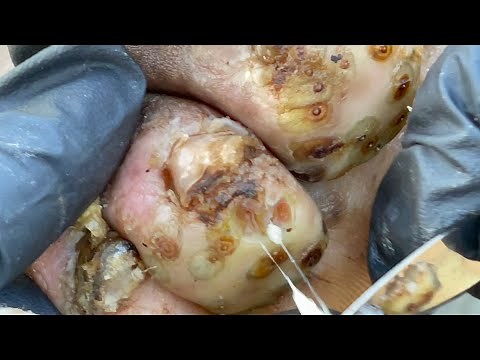 Fostine's jiggers - subscribe to our website for new jigger videos daily