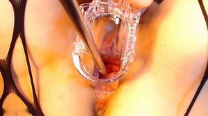 Self-Sounding_her_Cervix_02