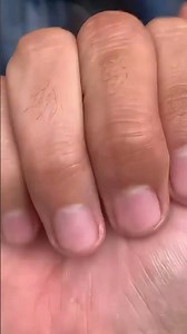 How does the fish grow?