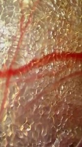 Fascia could be one of the most important factors affecting human health ❤️ Pictured is a visual of fascia surrounding a blood vessel, insanely fasci(a)nating isn’t it??? 🤯In the series “Strolling Beneath the Skin” by Dr. Jean Claude Guimberteau you can see the blood flowing but what is the MOST exciting aspect of this is the idea that the fascia is a giant sponge 🧽 soaking up the best parts of the blood in its jelly-like mess and delivering it to cells 🩸 All of this is apart of my new blog s