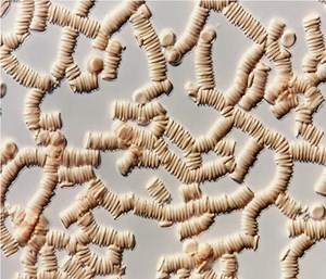 Erythrocyte aggregation - Alchetron, the free social encyclopedia