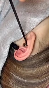 Let's Cleaning up videos 2025 💕💕 #pimplepop #acne #bleackheads #remove | Pimple Popping