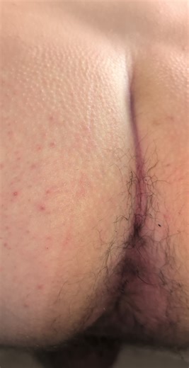 Pre-poop farts and daily turd