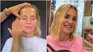 Dara se po uniklém videu od plastického chirurga stahuje do ústraní. Podpásovka, říká zklamaně - Expres.cz