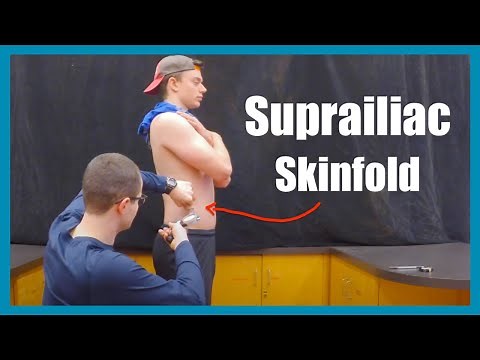 Suprailliac Skinfold