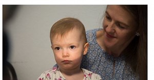 紅眼現象與Bruckner Test布魯克納測試篩檢臨床觀察