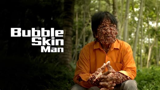 Bubble Skin Man (2012)