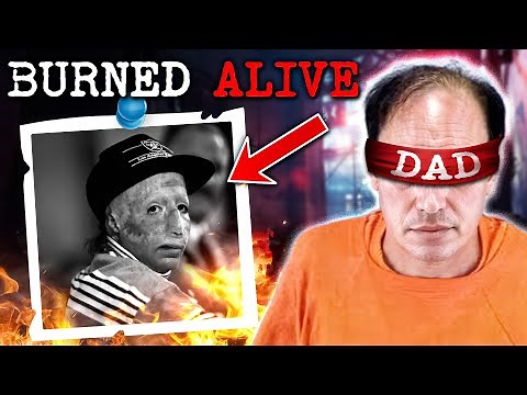 David Rothenberg - The Boy Who Was Burned Alive by Father Over Custody