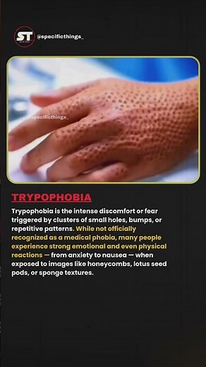 Trypophobia: The Strange Fear of Tiny Holes 😨 | Why It Feels So Disturbing. #shortsfeed #factshorts