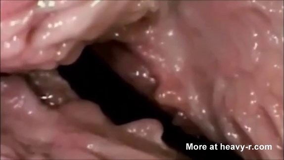 Internal View Of Vagina During Penetration