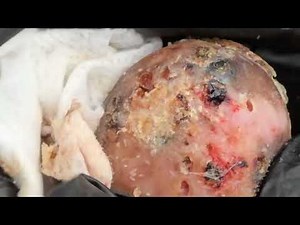 Jigger Removal: A Step-by-Step Guide with Jim Nduruchi and Rise Up Society Exclusive Member Preview