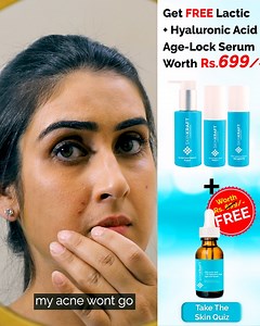 18M views · 99 reactions | "This skin quiz made it SO easy for me to...