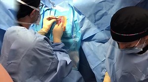 Labia Minoraplasty Surgery