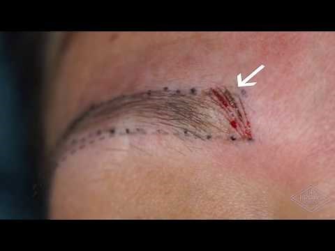 Microblading Depth & Stroke Placement demonstration