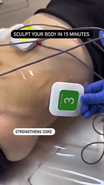 3 comments | Reveal a toned and sculpted physique with truFlex at @iciparisskinclinic.⁣ ⁣ #truFlex is a personalized muscle sculpting treatment that’s uniquely tailored to your own fitness level and goals. ⁣ ⁣ Book a provider near you now. #linkinbio | Cutera | Facebook