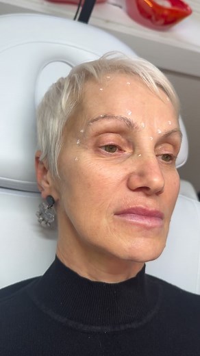 ✨Lips Lips Lips✨ #lipfiller #dermalfiller #restylane #galderma #dysport #botox #cosmeticnurse #cosmeticnurseinjector #aesthetics #aestheticmedicine #aestheticnurse #sculptra #aestheticnurseinjector #plateletrichplasma #prp #microneeding #cannula #cannulalips | Beauty & Grace Cosmetics