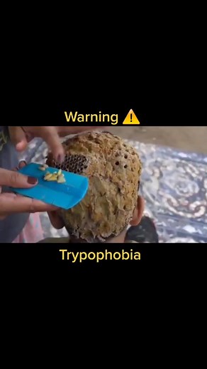 Overcoming Your Unbelievable Phobia: Tips and Tricks