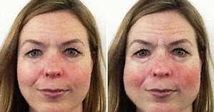 App mostra impacto de bebida sobre visual das mulheres