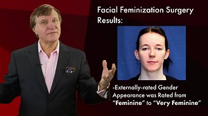 46 reactions | Facial feminization surgery (FFS) can serve as a...
