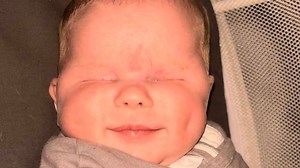 Baby born without eyes, diagnosed with rare genetic disorder