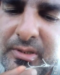 19K views · 107 reactions | Fishing in Lebanon الصيد البحري في لبنان on Reels | Facebook