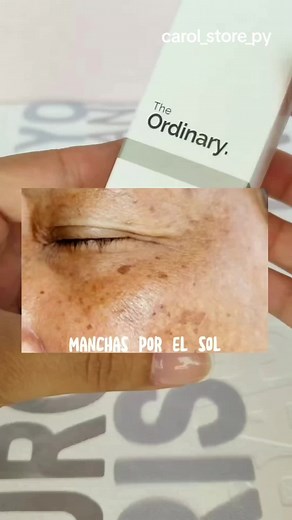 ¿Tienes manchas? 🤔 Alfa Arbutina The Ordinary el activo perfecto para tratarla recomendado 💖 lo conseguis en carol_store_py #theordinaryparaguay #alfaarbutina #antimanchas #carolstorepy #skincareparaguay #niacinamida