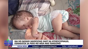 13 reactions | Maituturing na isang survivor ang isang bata dahil kahit na tinaningan na ito ng doktor dahil sa sakit na hydrocephalus, hanggang ngayon ay lumalaban pa rin ito. Pero sa ngayon kinakailangan ng pamilya ang pantustos para sa pang araw-araw ng bata. || via Kristel Dorado | Alpha News Philippines | Facebook