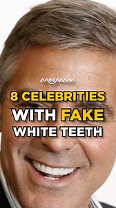 Ever wondered how some celebrities achieve their perfect smiles? We reveal 8 celebrities with fake white teeth—whether it’s veneers, porcelain fixes, or pricey dental work. #CelebrityVeneers #HollywoodSecrets #PerfectTeeth #AListSmiles #CosmeticDentistry #CelebrityTransformation #DentalVeneers #CelebrityGossip #CelebrityLooks #HollywoodMakeover #FlawlessSmiles #HollywoodGlam #FamousTeeth #SmileGoals #DentalMakeover #FakeTeeth #HollywoodBeauty | MTN