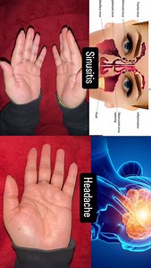 Mudra For Sinusitis & Headache 🌱🧘‍♀️ Practice Linga mudra and Mahasirs Mudra 🌸 Follow ~ @shivangiyogastudio Follow ~ @shivangiyogastudio #yoga #mudra #headache #sinusitis #viral | yoga_withshivi