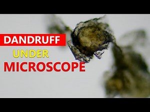 Dandruff Under A Microscope | Aimless Experiments 2022