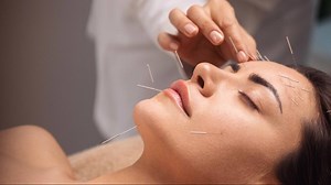 Acupuncture isn’t just about pain relief: Five myths busted
